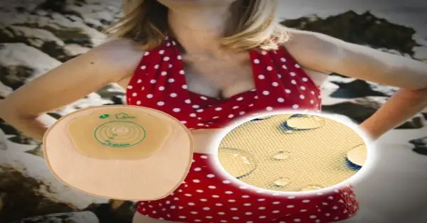 Κολοστομία και Θάλασσα + 11 Συμβουλές για την Καθημερινότητα με Στομία