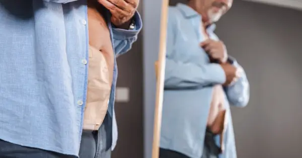 Colostomy Surgery: What You Need to Know