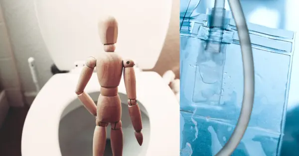 Επίσχεση ούρων: Αιτία & Ποιος Είναι ο Κατάλληλος Καθετήρας;